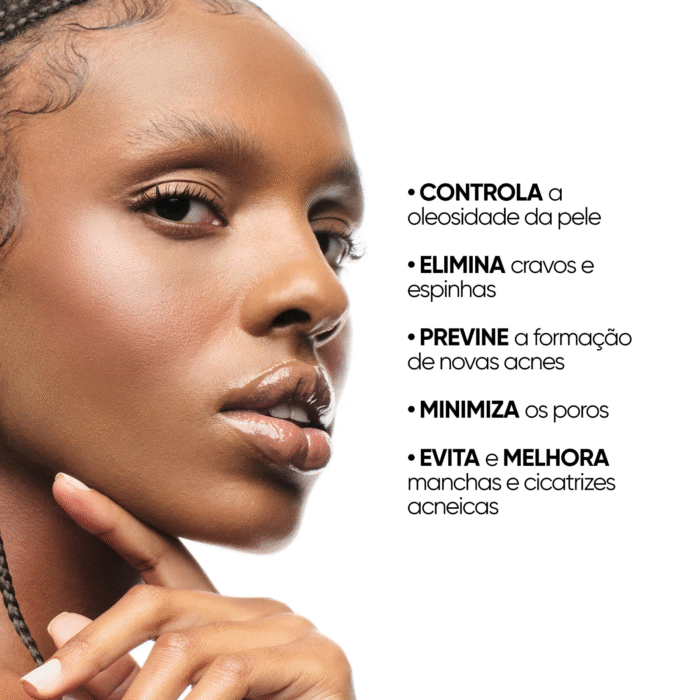 Sérum facial antiacne e oleosidade 10% ácido glicólico + 0,5% ácido salicílico - Image 4